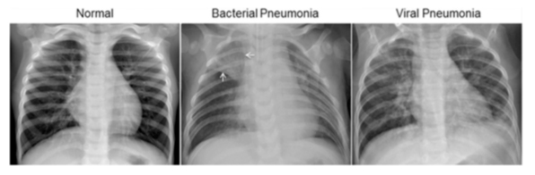 deep-learning-covid19